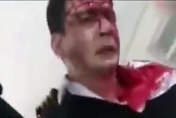 تنها بازمانده حادثه سقوط هواپیمای باری ارتش: