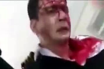 تنها بازمانده حادثه سقوط هواپیمای باری ارتش: