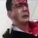 تنها بازمانده حادثه سقوط هواپیمای باری ارتش: