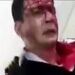 تنها بازمانده حادثه سقوط هواپیمای باری ارتش: