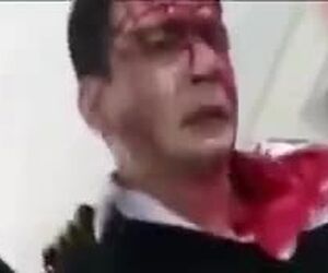 تنها بازمانده حادثه سقوط هواپیمای باری ارتش: