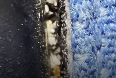 گزارش نگران‌کننده از وجود ساس در کابین پرواز KLM